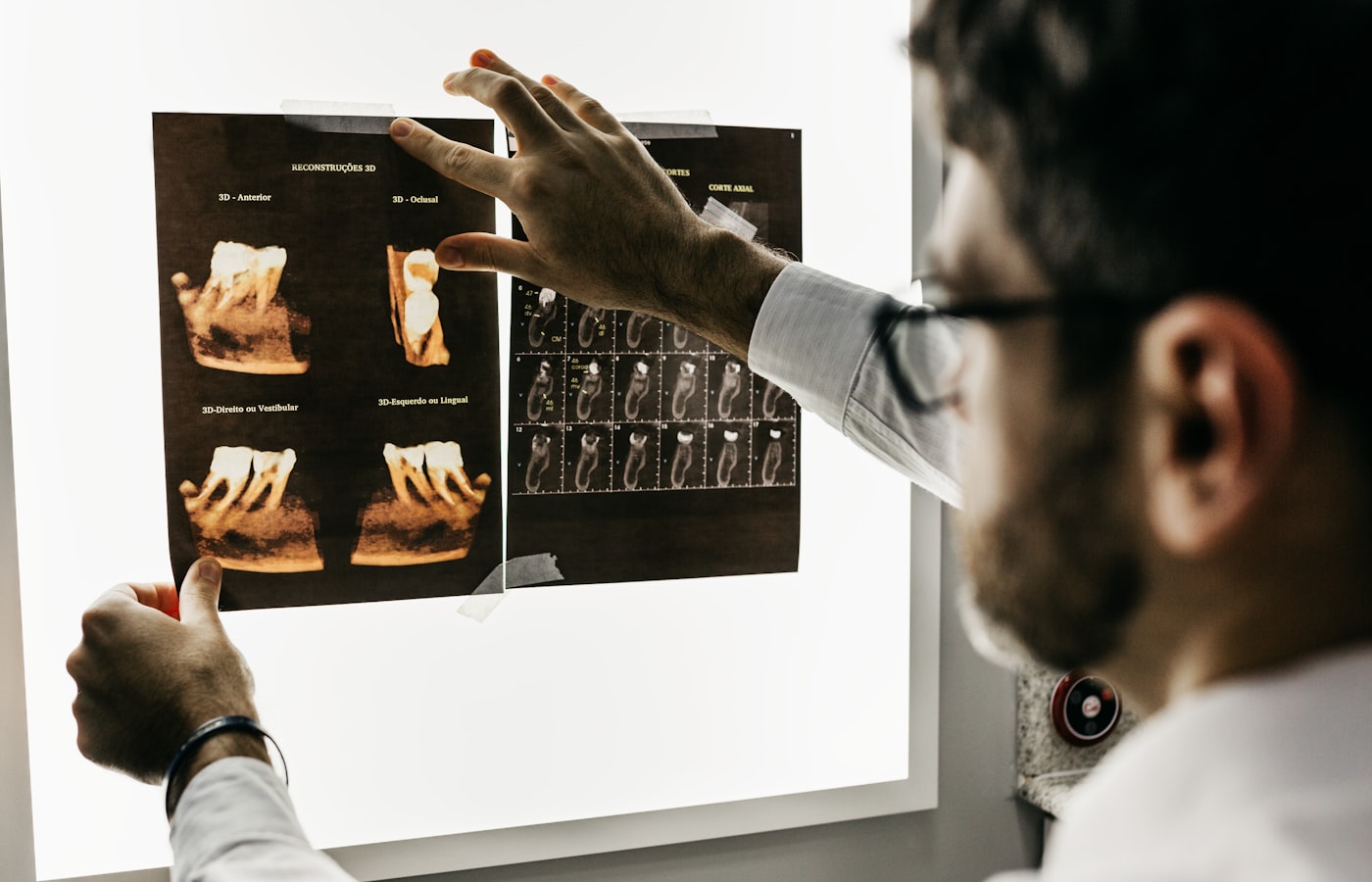 PURO Kalkschutz am Hauptzulauf in Praxis und Klinik – geschützte Gebäudetechnik und Spülbereiche